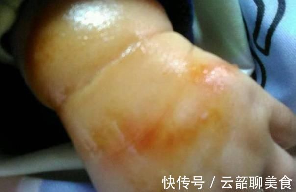 张病危|宝宝对不起!一个让全家人悔恨一辈子的日子!