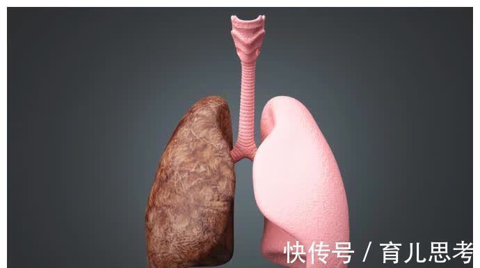 胰腺癌|癌症在发作前2年征兆,放到圈子很多人会感激你一辈子!