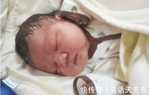 佝偻病|宝宝囟门又被称为“命门”,出现这三种现象时,要去医院