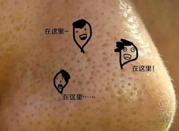 女生想有“婴儿鼻”晨起坚持3个习惯，或助你远离“草莓鼻”