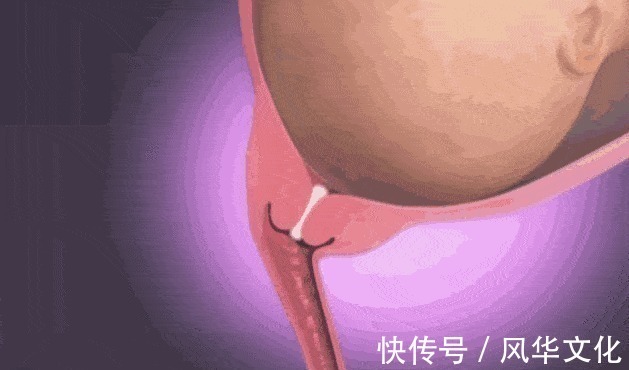 胎膜|顺产到底有多疼,给你们看完这18图片,就能真正理解女人不容易