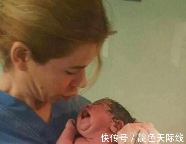 脐带|宝宝刚刚生下,医生要剪脐带时,宝宝的动作,让医生出了一身冷汗