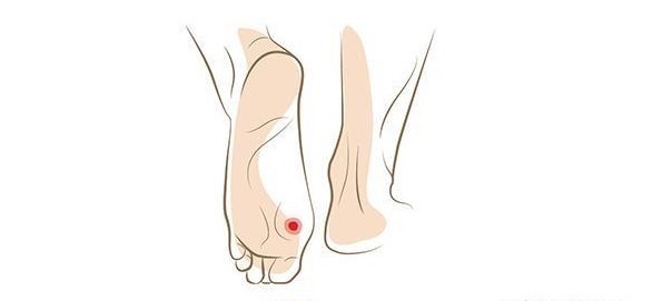 异常|血糖过高时,脚上会出现4个异常,三种食物,劝你还是戒掉吧