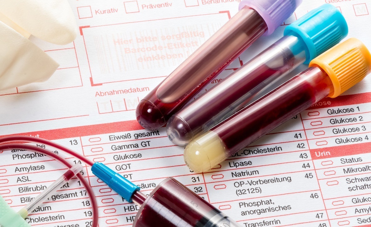 高血糖|与高血压、高血脂、高血糖齐名称为“四高”,这项检查用处多