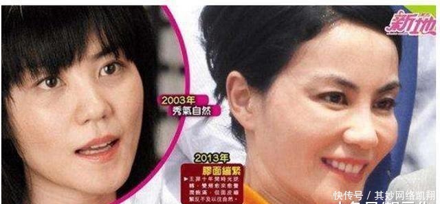 垮掉|明星都爱打玻尿酸, 但你一定没看过她们脸垮掉的样子