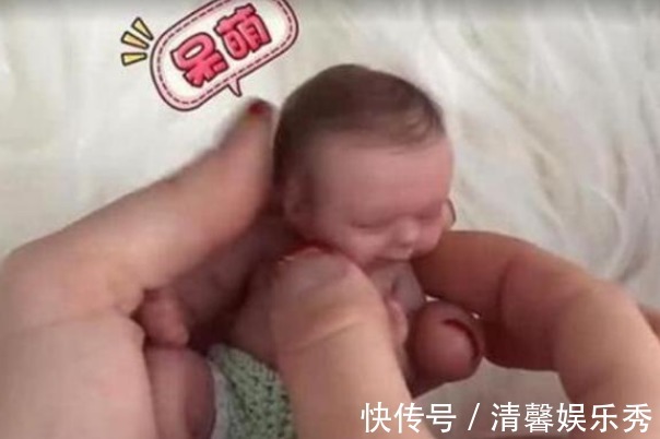 医生们|18年前那个出生时仅25厘米,体重半斤的女婴,如今变化太大了!