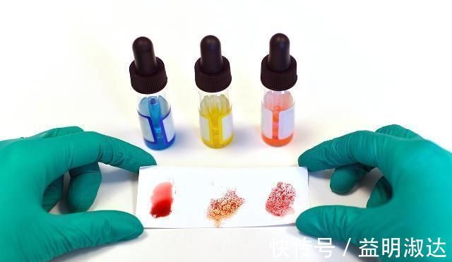 寿命|血型与寿命有关这种血型也许最“长寿”,现在知道还不算晚