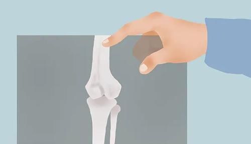 骨头|人老后,为什么驼背、长白发、有老人斑?原因清楚了