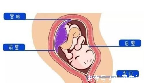 子宫壁|胎盘前壁是男孩,后壁是女孩?别说,胎盘的位置还真深藏“玄机” 美妈很帅