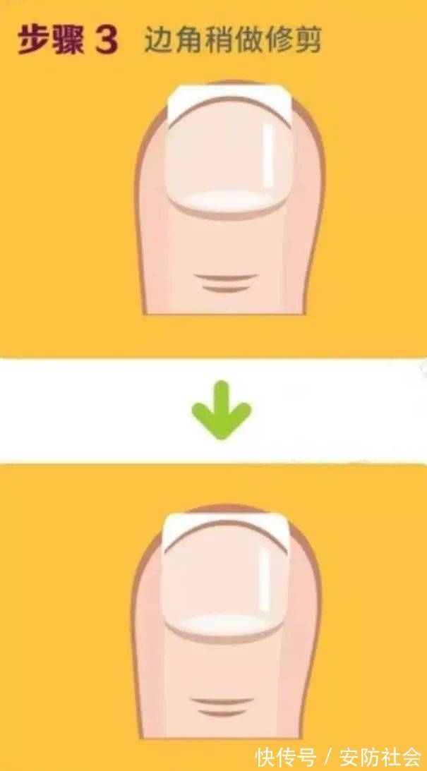 指甲缝|指甲剪不对带来大麻烦,这才是剪指甲的正确方法!