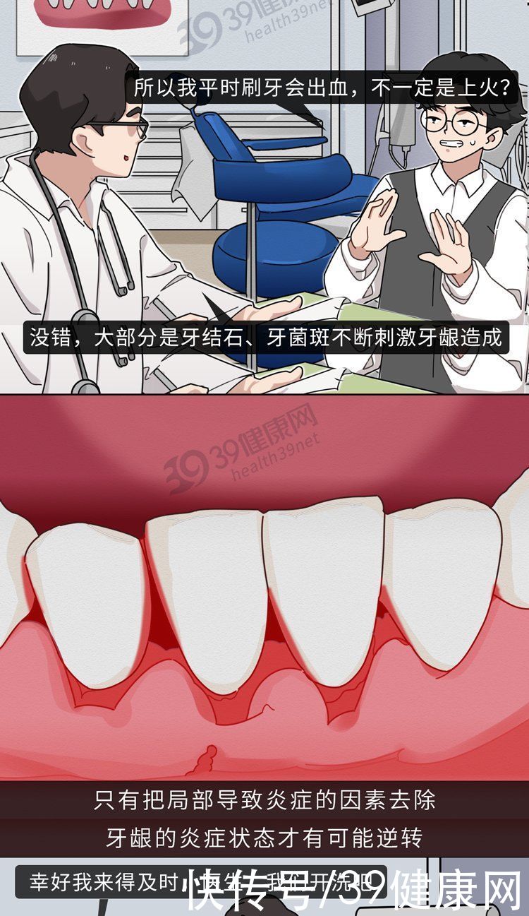 中华|不洗牙，你永远不知道牙齿里面有多脏！看完这篇就拿定主意了