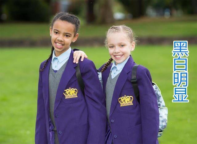 夫妻俩|夫妻俩生下“奥利奥”双胞胎,一个白一个黑差距大,如今成这样