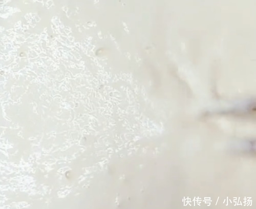 面粉|夏天女儿就馋这早餐,手不粘面筷子一搅,酥皮香软,比油条还好吃