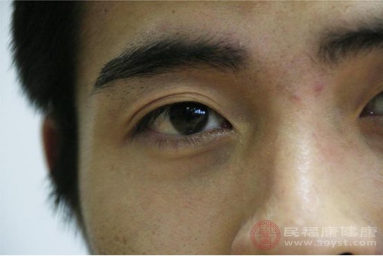 眼皮下垂了怎么办
