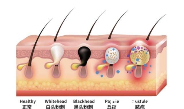 护肤品 哪些皮肤问题是护肤品不能解决的!