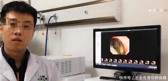 家长|12岁女孩腹痛两年,肚子里出现马蹄形状的团块,都怪家长太粗心