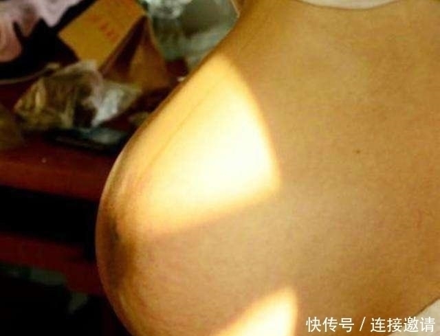 怀孕|孕妇悬垂肚走红,头一次见到这种肚型,网友至少双胞胎吧