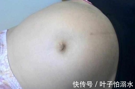 女子|女子生完孩子肚子疼,医生拍片坚持后,傻住