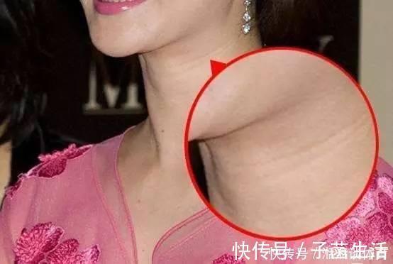 肌肤|无论男女,脖子上出现这种“问题”,别大意!赶紧采取措施