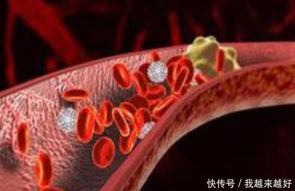中老年人多吃2道菜,清除血管垃圾,预防血栓,血管到老不堵塞