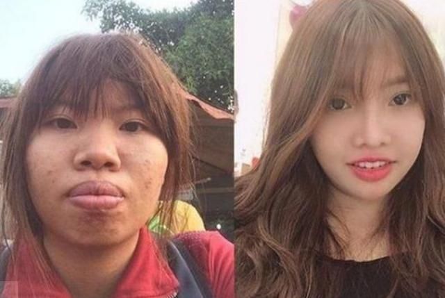 怀孕|怀孕后变丑太“烦恼”,孕妈了解原因的同时,调整心态也很重要