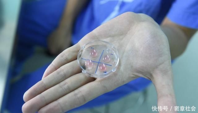 慢性合并症|女人只有6年的“黄金生育年龄”,你知道哪6年吗