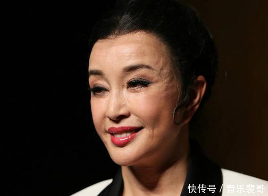 不老女神|还有多少女明星为了变美，而去饮鸩止渴打玻尿酸