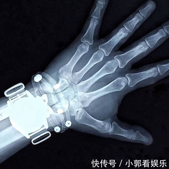 什么腕表在国外风靡,国内被低估但未来5年能增值 潜力型