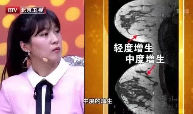 血流|2年没复查，息肉变成癌！B超报告里出现“这些字眼”可能就危险了，别等严重时才后悔