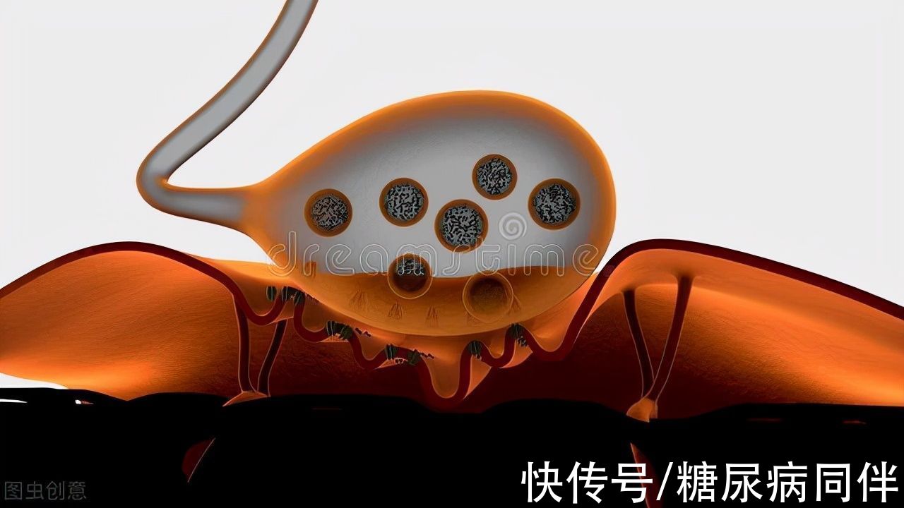 病變|糖尿病人下肢痛如刀割，怎么辦？