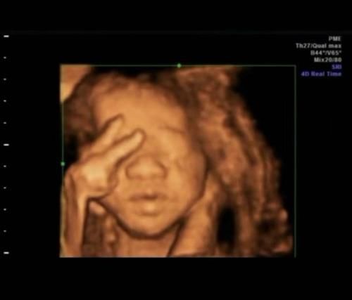 产妇|产妇产检做“四维”,胎儿在子宫里“数数”医生:下一个数学天才