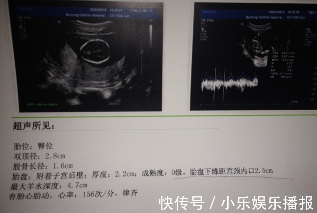 可能性|孕期,孕妈做四维彩超若有这些信号,怀男孩的可能性大吗