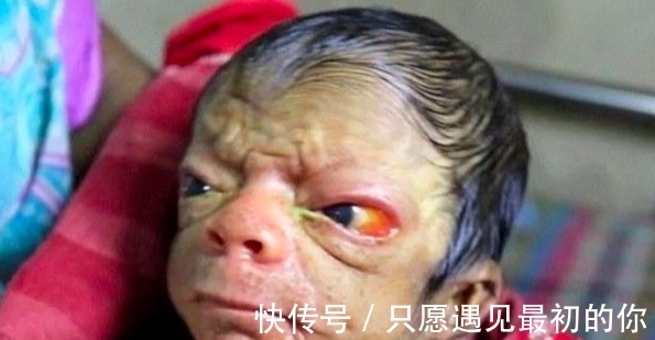 奇葩|国外奇葩婴儿“返老还童”,一出生如同80岁老头,父母不惊反喜!