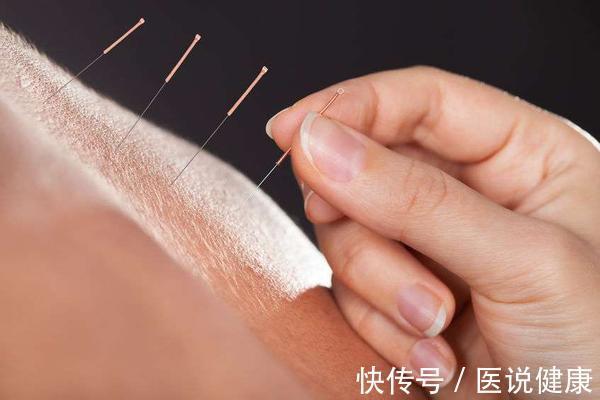 热敷|颈椎出现不舒服症状时,试试这4个方法,或能帮你缓解!