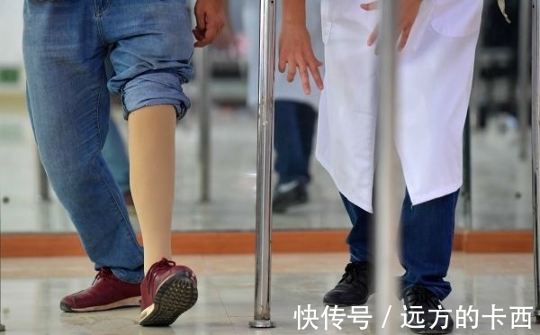 脑机|截肢者“福音”:脑机接口可让思维控制假肢