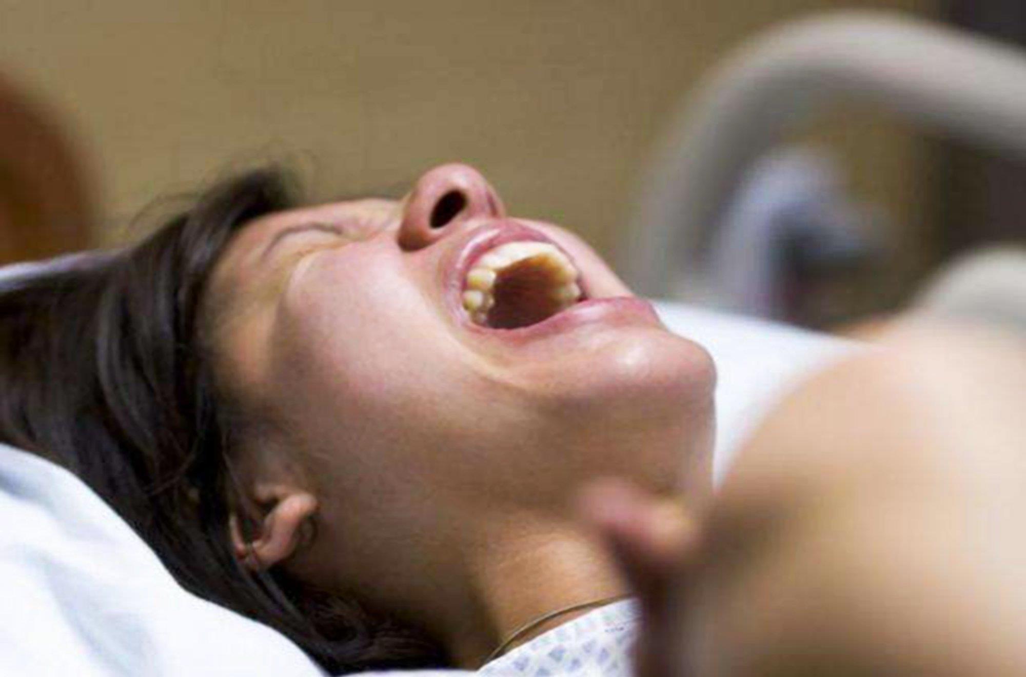 自然分娩|“大夫,我能换个姿势吗?”宝妈这句话,为宝宝免去“产钳”之苦