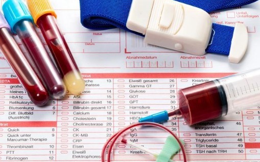 好习惯|不想糖尿病损害肾功能，养成5个好习惯，到老你也不会尿毒症