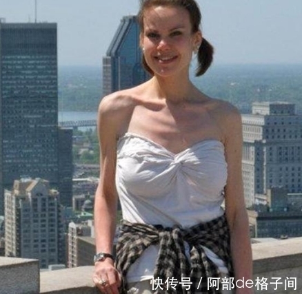 增肥|她意识到健康问题后，用了3年减肥，减掉280斤又增肥47斤？