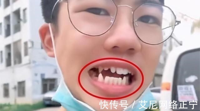 刷牙|17岁儿子长尖牙，亲妈吐槽像“吸血鬼”，网友：也可能是个狼人