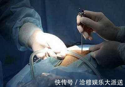 膳食纤维|为什么说“富人得肠癌,穷人得胃癌”分别要注意什么说清楚了