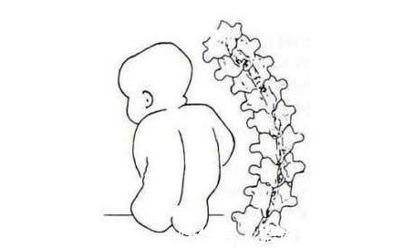 宝宝|想知道宝宝几个月开始学坐?先了解下孩子颈椎发育的过程