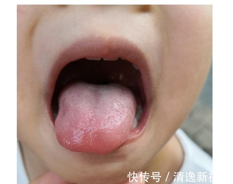 肖主任|退休院士声明爱积食的孩子，早晚2件事，坚持4天，胜吃消食片