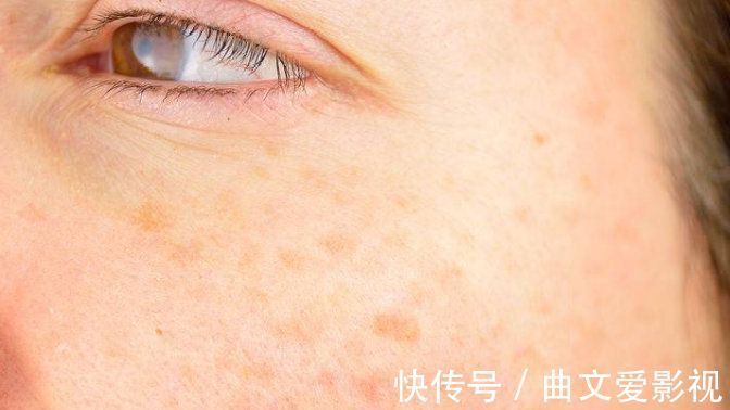 桑椹|气血虚容易老,1个食疗方比吃10斤阿胶帮助还大,还花钱少!