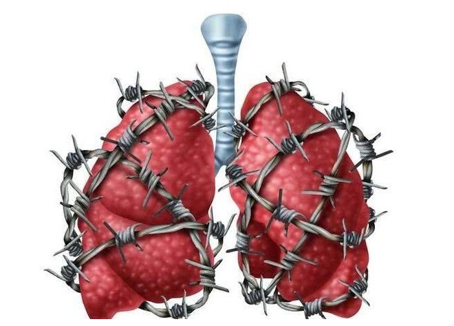 菊苣|五十岁后,若能熬过这3道寿命坎,很可能会迎来长寿!
