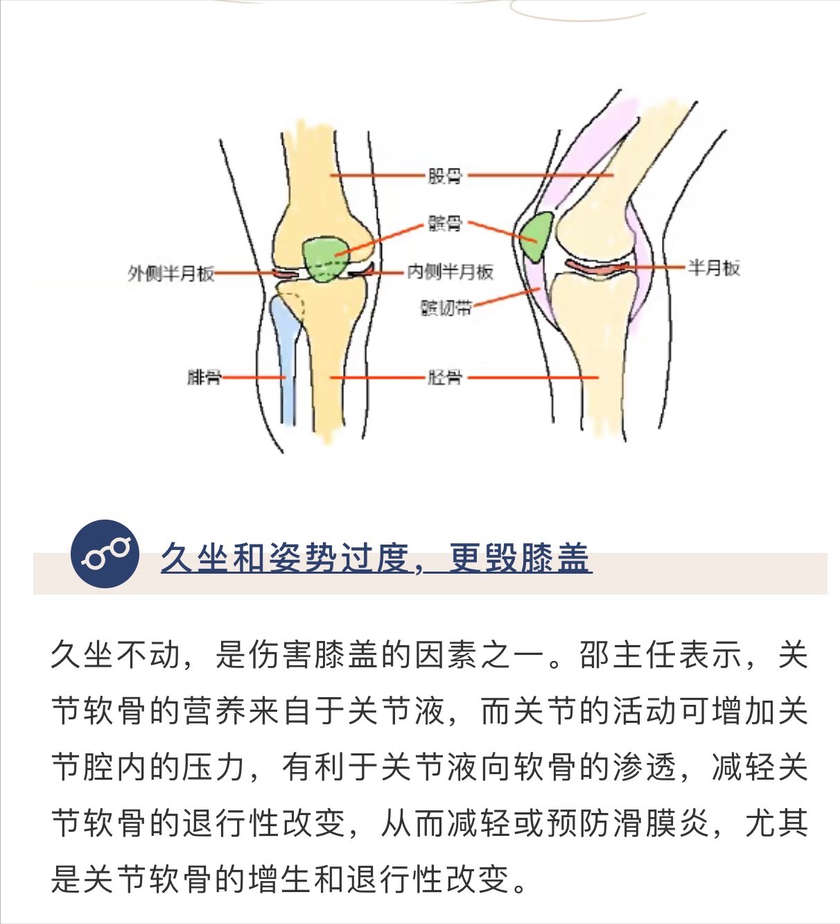 当心|运动不当膝关节会“报废”？当心越练病越多