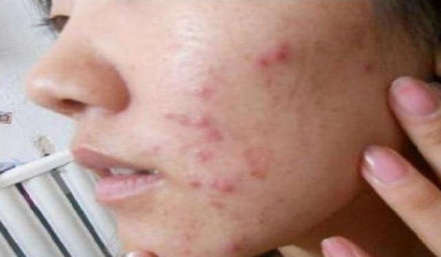 黑眼圈|女性脸部有4个“症状”别马虎,可能得了妇科病,要足够重视