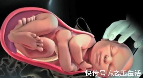 产妇们|宫缩时产妇疼得“死去活来”,胎儿是啥感觉,看完憋住别笑