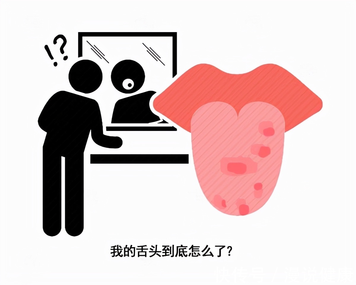 患者|口腔溃疡反反复复?提醒:溃疡有这些特点,小心跟舌癌有关系!