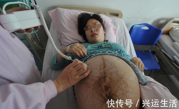 女子|25岁女子怀孕3个月,发现连走路都变得困难,医生的话让老公忧心