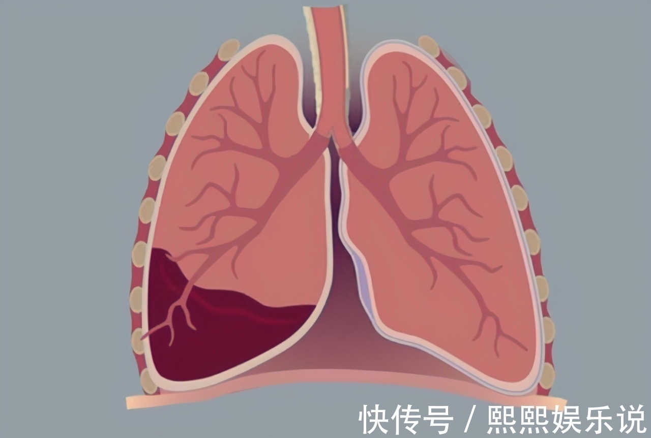 复发|看中医效果显著而忽视病情，发现肿瘤已是晚期，治疗后复发咋办